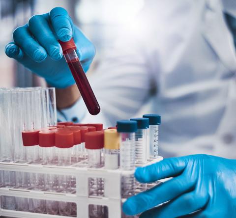 Blood Testing | ViroMed